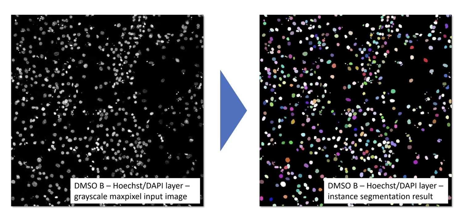 StarDist Segmentation Results